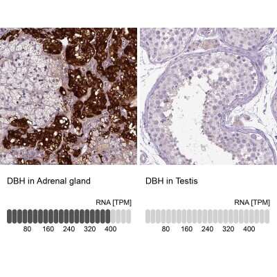 Immunohistochemistry-Paraffin: Dopamine beta-Hydroxylase Antibody [NBP2-55677]