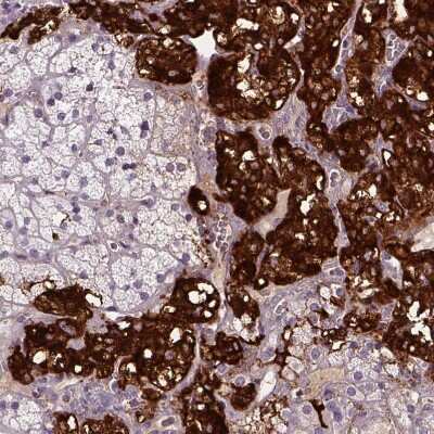 Immunohistochemistry-Paraffin: Dopamine beta-Hydroxylase Antibody [NBP2-55677]