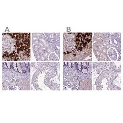 Immunohistochemistry-Paraffin: Dopamine beta-Hydroxylase Antibody [NBP2-55677]