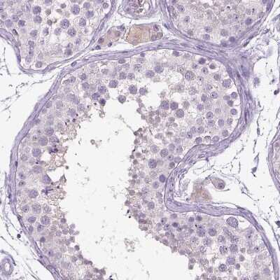 Immunohistochemistry-Paraffin: Dopamine beta-Hydroxylase Antibody [NBP2-55677]