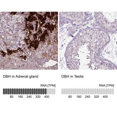 Immunohistochemistry-Paraffin: Dopamine beta-Hydroxylase Antibody [NBP2-57836]