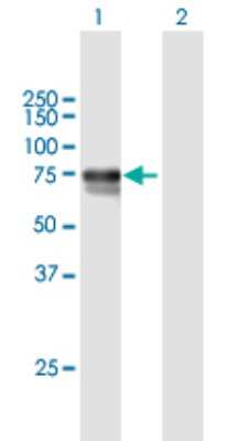 Western Blot: Dopamine beta-Hydroxylase Antibody [H00001621-B01P]