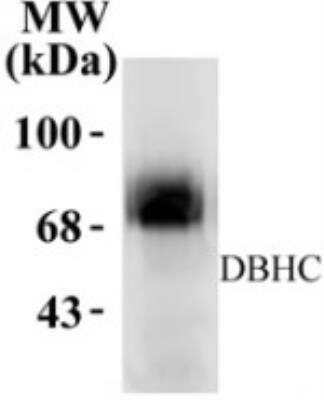 Western Blot: Dopamine beta-Hydroxylase Antibody [NB300-111]