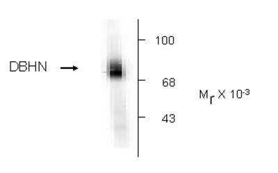 Western Blot: Dopamine beta-Hydroxylase Antibody [NB300-112]