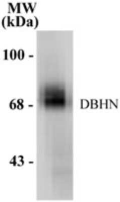 Western Blot: Dopamine beta-Hydroxylase Antibody [NB300-112]