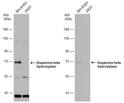 Western Blot: Dopamine beta-Hydroxylase Antibody [NBP1-31386]