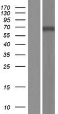 Western Blot: Dopamine beta-Hydroxylase Overexpression Lysate [NBL1-09727]