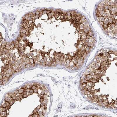 Immunohistochemistry-Paraffin: Doppel Antibody [NBP2-31928]