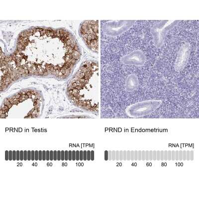Immunohistochemistry-Paraffin: Doppel Antibody [NBP2-31928]