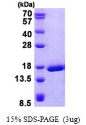 SDS-PAGE: Recombinant Human Doppel His Protein [NBP2-23361]