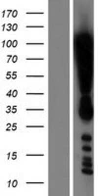 Western Blot: DOT1L Overexpression Lysate [NBL1-09984]