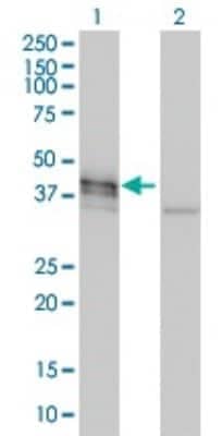 Western Blot: Doublecortin Antibody (1G12) [H00001641-M01]