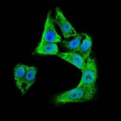 Immunocytochemistry/ Immunofluorescence: Doublecortin Antibody (2G5) - BSA Free [NBP2-37476]