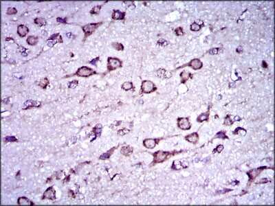 Immunohistochemistry-Paraffin: Doublecortin Antibody (2G5) - BSA Free [NBP2-37476]