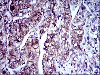 Immunohistochemistry-Paraffin: Doublecortin Antibody (2G5) - BSA Free [NBP2-37476]