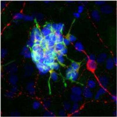 Immunocytochemistry/ Immunofluorescence: Doublecortin Antibody (3E1) [NBP1-92684]