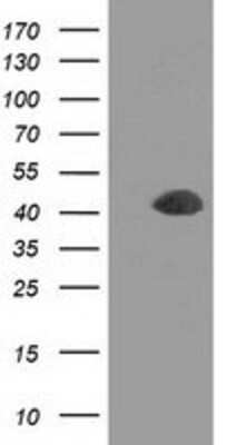 Western Blot: Doublecortin Antibody (OTI4A3) [NBP2-03081]