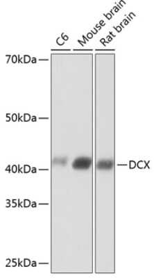 Western Blot: Doublecortin Antibody (6H1B3) [NBP3-15628]