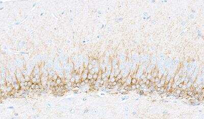 Immunohistochemistry-Paraffin: Doublecortin Antibody (BLR168J) [NBP3-14742]