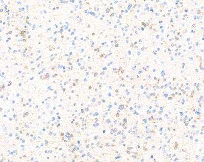 Immunohistochemistry-Paraffin: Doublecortin Antibody (BLR168J) [NBP3-14742]