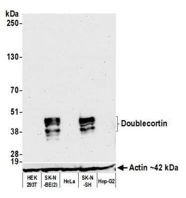 Western Blot: Doublecortin Antibody (BLR168J) [NBP3-14742]