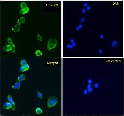 Immunocytochemistry/ Immunofluorescence: Doublecortin Antibody [NBP1-72042]