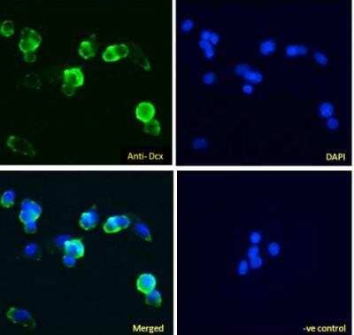 Immunocytochemistry/ Immunofluorescence: Doublecortin Antibody [NBP2-26149]