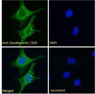 Immunocytochemistry/ Immunofluorescence: Doublecortin Antibody [NBP2-69992]