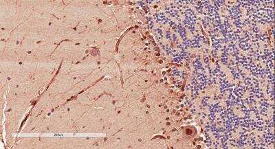 Immunohistochemistry-Paraffin: Doublecortin Antibody [NBP1-72042]