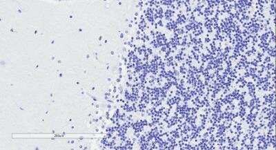 Immunohistochemistry-Paraffin: Doublecortin Antibody [NBP1-72042]