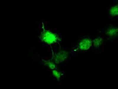 Immunocytochemistry/ Immunofluorescence: Doublecortin Antibody (OTI4A3) - Azide and BSA Free [NBP2-70558]