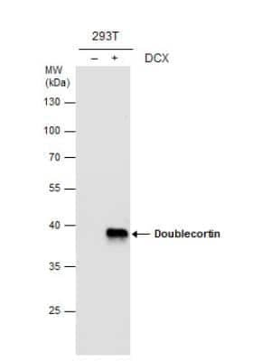 Western Blot: Doublecortin Antibody [NBP1-32662]