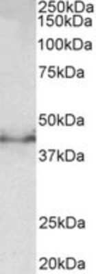 Western Blot: Doublecortin Antibody [NBP2-26149]