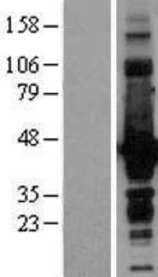 Western Blot: Doublecortin Overexpression Lysate [NBL1-09760]