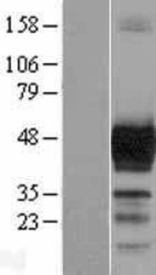 Western Blot: Doublecortin Overexpression Lysate [NBL1-09761]