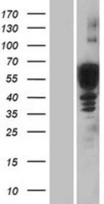 Western Blot: Doublecortin Overexpression Lysate [NBP2-11166]