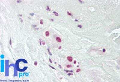 Immunohistochemistry-Paraffin: DPPA4 Antibody [NBP2-24656]