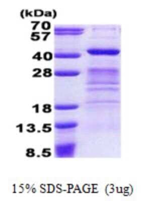 SDS-PAGE: Recombinant Human DPPA4 His Protein [NBP2-22998]