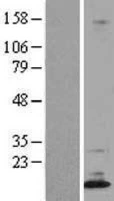 Western Blot: DPPA5/ESG1 Overexpression Lysate [NBL1-10004]