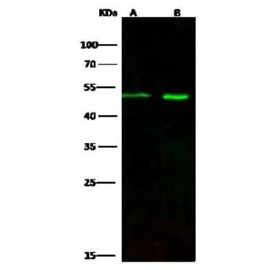 Western Blot: Draxin/C1orf187 Antibody [NBP2-97115]