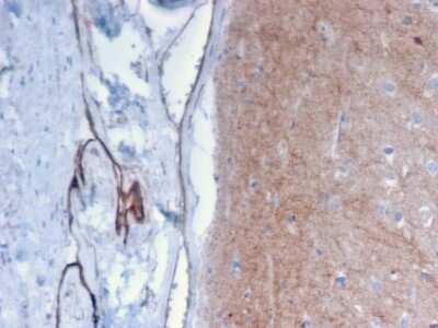 Immunohistochemistry-Paraffin: Drebrin 1 Antibody (DBN1/2879) [NBP2-79766]