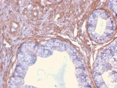 Immunohistochemistry-Paraffin: Drebrin 1 Antibody (DBN1/2879) [NBP2-79766]