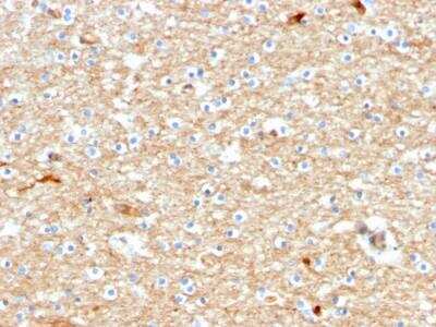 Immunohistochemistry-Paraffin: Drebrin 1 Antibody (DBN1/2880) - Azide and BSA Free [NBP2-79902]