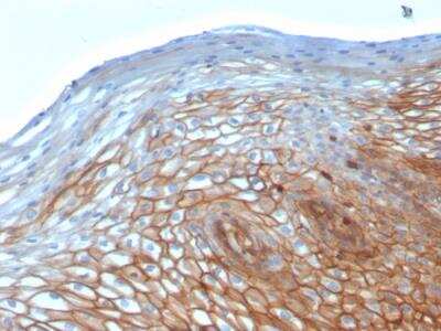 Immunohistochemistry-Paraffin: Drebrin 1 Antibody (DBN1/2880) - Azide and BSA Free [NBP2-79902]