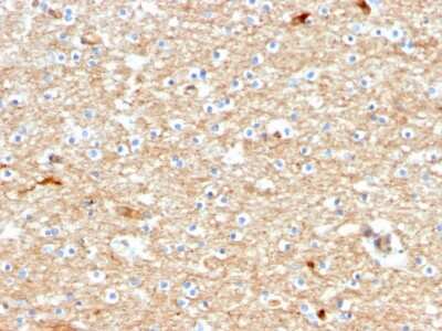 Immunohistochemistry-Paraffin: Drebrin 1 Antibody (DBN1/2880) [NBP2-79767]