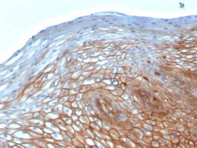 Immunohistochemistry-Paraffin: Drebrin 1 Antibody (DBN1/2880) [NBP2-79767]