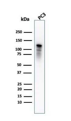 Western Blot: Drebrin 1 Antibody (DBN1/2880) [NBP2-79767]