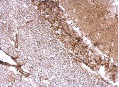 Immunohistochemistry-Paraffin: Drebrin 1 Antibody [NBP2-14933]