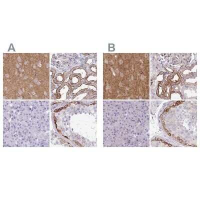 Immunohistochemistry-Paraffin: Drebrin 1 Antibody [NBP2-38650]