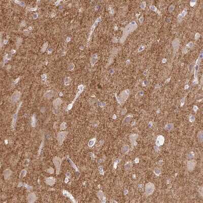 Immunohistochemistry-Paraffin: Drebrin 1 Antibody [NBP2-38813]